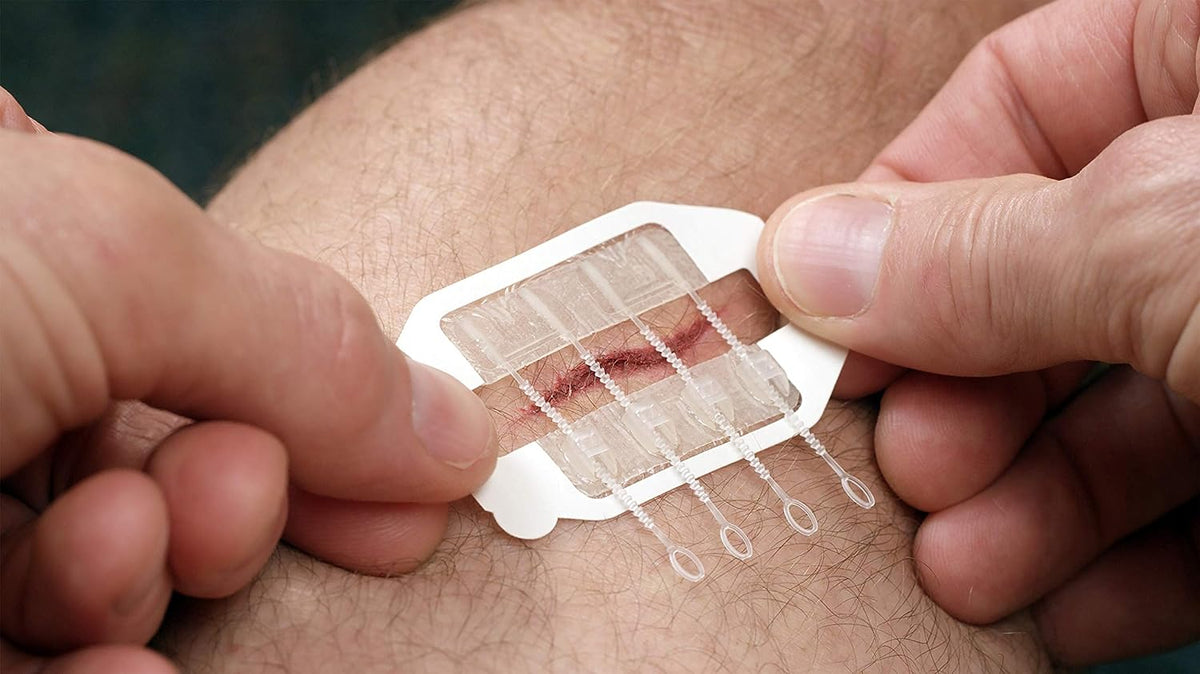 SurgicalQuality Skin Closure NonInvasive Wound Closure ZipStitch