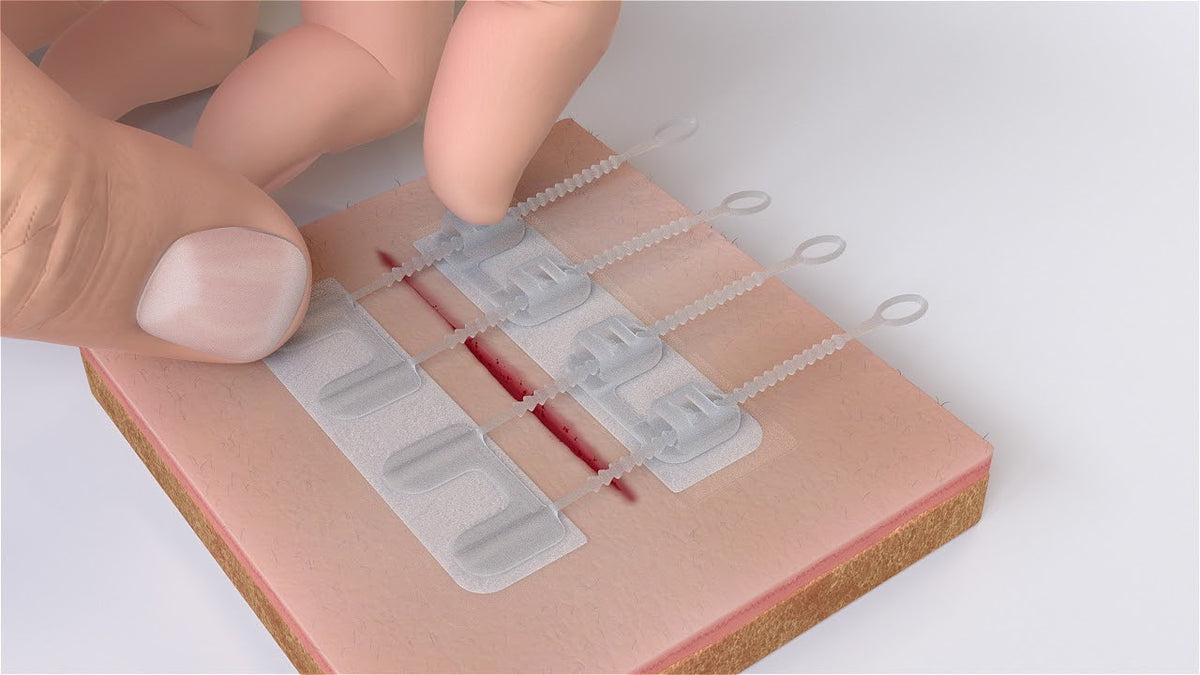 SurgicalQuality Skin Closure NonInvasive Wound Closure ZipStitch